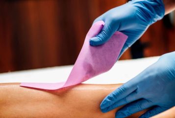 servicii de epilare vitan